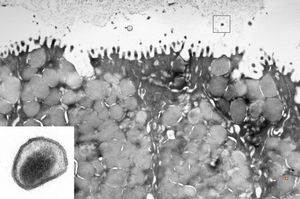 transversally cut microvillus - none virus! (stomach)